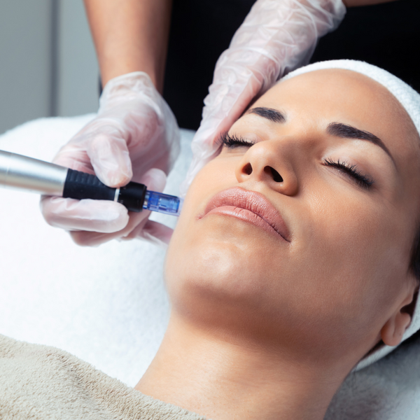 1 Microneedling